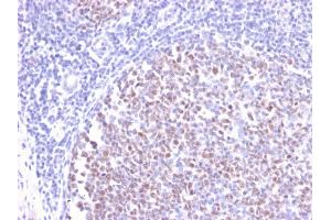 Formalin-fixed, paraffin-embedded human Tonsil stained with BCL-6 Rabbit Recombinant Monoclonal Antibody (BCL6/2497R). (Rekombinanter BCL6 Antikörper  (AA 256-389))