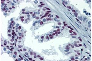 Human Prostate: Formalin-Fixed, Paraffin-Embedded (FFPE) (SP1 Antikörper  (AA 89-199))