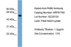 WB Suggested Anti-PKM2  Antibody Titration: 0. (PKM2 Antikörper  (Middle Region))