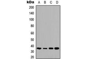 Western blot analysis of TMBIM1 expression in HeLa (A), HepG2 (B), mouse brain (C), rat kidney (D) whole cell lysates. (TMBIM1 Antikörper  (C-Term))
