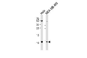 Western blot analysis of lysates from Hela, MDA-MB-468 cell line (from left to right), using SNRPG Antibody (N-term) (ABIN6242749 and ABIN6577533). (SNRPG Antikörper  (N-Term))