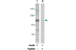 Western blot analysis of extracts from 293 cells, treated with insulin (0. (BRAF Antikörper)