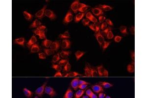 Immunofluorescence analysis of HeLa cells using ARHGAP1 Polyclonal Antibody at dilution of 1:100. (ARHGAP1 Antikörper)