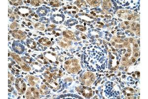ZNF169 antibody was used for immunohistochemistry at a concentration of 4-8 ug/ml to stain Epithelial cells of renal tubule (arrows) in Human Kidney.