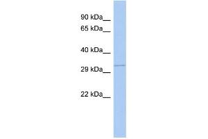 Western Blotting (WB) image for anti-Guanine Nucleotide Binding Protein (G Protein), beta Polypeptide 1 (GNB1) (N-Term) antibody (ABIN2785813)