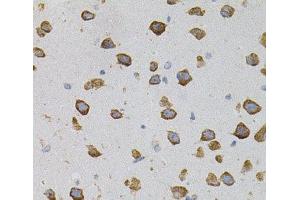 Immunohistochemistry of paraffin-embedded Mouse brain using VEGFC Polyclonal Antibody (VEGFC Antikörper)