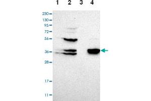 Western blot analysis of Lane 1: Human cell line RT-4, Lane 2: Human cell line U-251MG sp, Lane 3: Human plasma (IgG/HSA depleted), Lane 4: Human liver tissue with CGRRF1 polyclonal antibody  at 1:100-1:250 dilution. (CGR19 Antikörper)