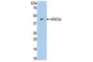 Detection of Recombinant ITGaM, Human using Polyclonal Antibody to Integrin Alpha M (CD11b) (CD11b Antikörper  (AA 301-451))