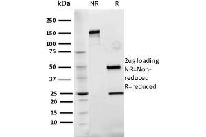 SDS-PAGE Analysis Purified Fibronectin Mouse Monoclonal Antibody (Fn-3). (Fibronectin 1 Antikörper)