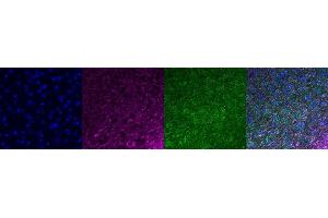 Immunohistochemistry (IHC) image for anti-Microtubule-Associated Protein 2 (MAP2) antibody (ABIN7456240) (MAP2 Antikörper)