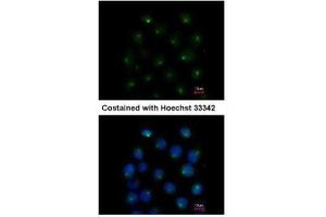 ICC/IF Image Immunofluorescence analysis of methanol-fixed A431, using SAR1A, antibody at 1:500 dilution.