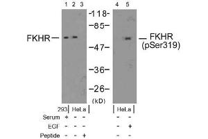 Image no. 2 for anti-Forkhead Box O1 (FOXO1) (pSer319) antibody (ABIN196849) (FOXO1 Antikörper  (pSer319))