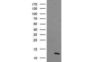 Image no. 1 for anti-D-Dopachrome Tautomerase (DDT) antibody (ABIN1497794) (DDT Antikörper)