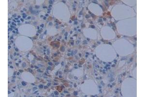 Used in DAB staining on fromalin fixed paraffin- embedded stomach tissue (MACC1 Antikörper  (AA 522-784))