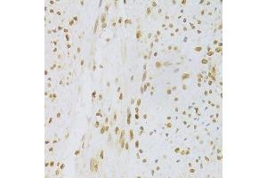 Immunohistochemistry of paraffin-embedded human leiomyoma of uterus using HMGB1 Antibody. (HMGB1 Antikörper  (AA 100-200))