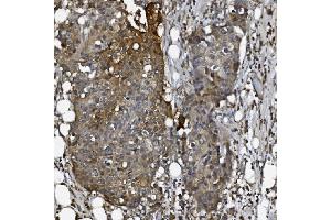 IHC analysis of ALK-1/ACVRL1 using anti-ALK-1/ACVRL1 antibody (ABIN7601037).