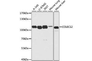 Western blot analysis of extracts of various cell lines, using COLEC12 antibody. (COLEC12 Antikörper  (AA 60-270))
