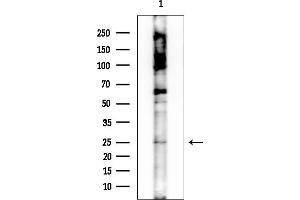 Western blot analysis of lysates from Rat brain, using OR10 Antibody at 1/1000 dilution.