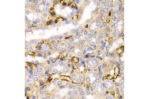 Immunohistochemistry of paraffin-embedded rat kidney using NEFL antibody. (NEFL Antikörper)