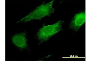 Immunofluorescence of monoclonal antibody to FAIM2 on HeLa cell.
