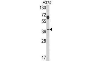 Western blot analysis of PSMD7 Antibody (N-term) in A375 cell line lysates (35ug/lane). (PSMD7 Antikörper  (N-Term))
