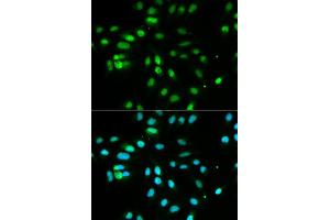 Immunofluorescence analysis of MCF7 cell using PAX3 antibody. (Paired Box 3 Antikörper  (AA 1-206))