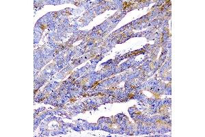 IHC analysis of CD2AP using anti-CD2AP antibody (ABIN6719544). (CD2AP Antikörper  (AA 253-337))