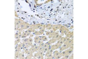 Immunohistochemistry of paraffin-embedded human liver injury using LETMD1 antibody at dilution of 1:100 (x40 lens).