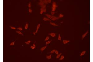 ABIN6266634 staining HEPG2 cells by ICC/IF.