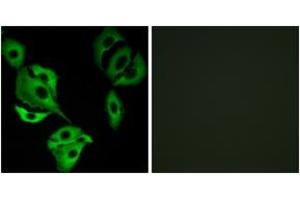 Immunofluorescence analysis of A549 cells, using ADCK4 Antibody.