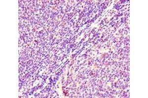 Immunohistochemistry of paraffin-embedded human lymphoid tissue using ABIN7178885 at dilution of 1:100 (HRAS Antikörper  (AA 2-186))