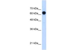 Western Blotting (WB) image for anti-Glycosyltransferase-Like Domain Containing 2 (GTDC2) antibody (ABIN2463244)