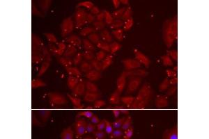 Immunofluorescence analysis of U2OS cells using TPP2 Polyclonal Antibody (Tpp2 Antikörper)