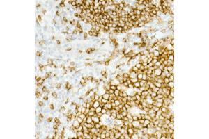 Immunohistochemistry of paraffin-embedded Human tonsil using CD19 antibody (ABIN7266169) at dilution of 1:10000 (40x lens). (CD19 Antikörper)