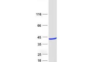 Validation with Western Blot (RASSF5 Protein (Transcript Variant 3) (Myc-DYKDDDDK Tag))