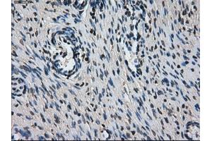 Immunohistochemical staining of paraffin-embedded colon tissue using anti-L1CAMmouse monoclonal antibody. (L1CAM Antikörper)