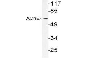 Western blot (WB) analyzes of AChE antibody in extracts from Jurkat cells. (Acetylcholinesterase Antikörper)