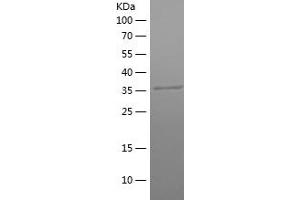 Western Blotting (WB) image for Phosphoglycerate Kinase 1 (PGK1) (AA 307-417) protein (His-IF2DI Tag) (ABIN7124415) (PGK1 Protein (AA 307-417) (His-IF2DI Tag))