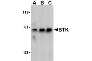 Western blot analysis of BTK in U937 cell lysate with AP30170PU-N BTK antibody at (A) 0. (BTK Antikörper  (N-Term))