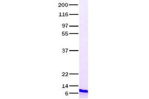 Western Blotting (WB) image for Transforming Growth Factor, alpha (TGFA) (Transcript Variant 1) (Active) protein (ABIN2733495)