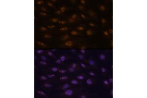 Immunofluorescence analysis of C6 cells using MyoD1 antibody  at dilution of 1:100. (MYOD1 Antikörper  (AA 150-250))