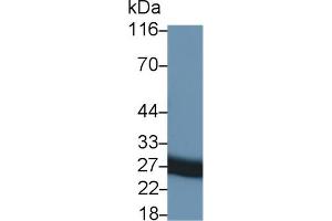 Detection of TIMP1 in Rat Seminal vesicle lysate using Monoclonal Antibody to Tissue Inhibitors Of Metalloproteinase 1 (TIMP1) (TIMP1 Antikörper  (AA 25-207))