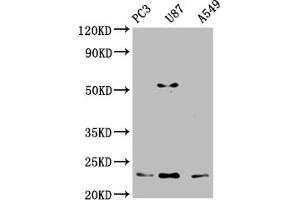 Western Blot Positive WB detected in: PC-3 whole cell lysate, U87 whole cell lysate, A549 whole cell lysate All lanes: FKBP11 antibody at 1:2000 Secondary Goat polyclonal to rabbit IgG at 1/50000 dilution Predicted band size: 23, 16 kDa Observed band size: 23 kDa (FKBP11 Antikörper  (AA 28-154))