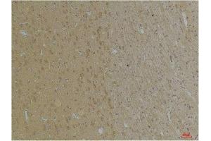 Immunohistochemical analysis of paraffin-embedded Rat BrainTissue using KCNK4 (TRAAK) Rabbit pAb diluted at 1:200. (KCNK4 Antikörper)