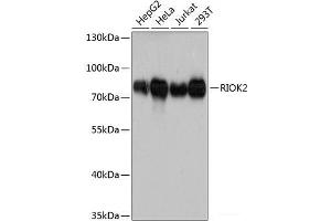 Western blot analysis of extracts of various cell lines using RIOK2 Polyclonal Antibody at dilution of 1:3000. (RIOK2 Antikörper)
