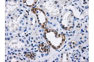 Immunohistochemical staining of paraffin-embedded Kidney tissue using anti-PPME1mouse monoclonal antibody. (PPME1 Antikörper)