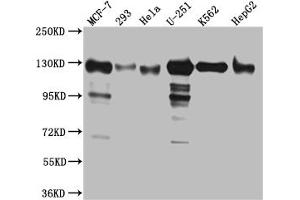 Western Blot Positive WB detected in: MCF-7 whole cell lysate, 293 whole cell lysate, Hela whole cell lysate, U-251 whole cell lysate, K562 whole cell lysate, HepG2 whole cell lysat All lanes: Eg5 Antibody at 1:1000 Secondary Goat polyclonal to rabbit IgG at 1/50000 dilution Predicted band size: 120 kDa Observed band size: 130 kDa (Rekombinanter KIF11 Antikörper)