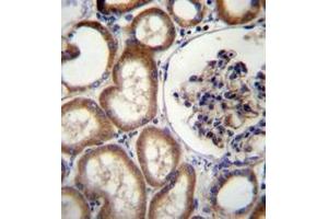 Immunohistochemistry (Paraffin-embedded Sections) (IHC (p)) image for anti-Membrane-Bound Transcription Factor Peptidase, Site 2 (MBTPS2) (AA 14-44), (N-Term) antibody (ABIN953342)
