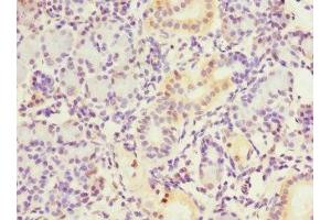 Immunohistochemistry of paraffin-embedded human pancreatic tissue using ABIN7149377 at dilution of 1:100 (NT5C3 Antikörper  (AA 37-336))