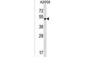 ZN Antibody (Center) (ABIN1538038 and ABIN2850129) western blot analysis in  cell line lysates (35 μg/lane). (ZNF559 Antikörper  (AA 196-224))